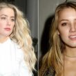amber heard before plastic surgery
