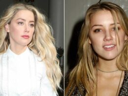 amber heard before plastic surgery