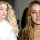 amber heard before plastic surgery