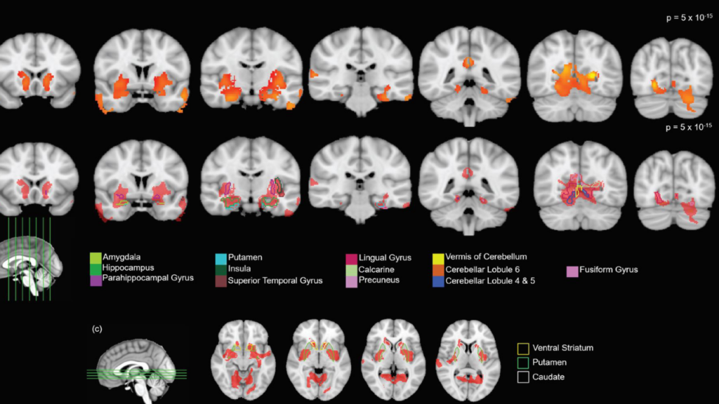 Weed's Effect on Teenagers? UIC Neuroscientists Study Marijuana's Effect on Teenage Minds Utilizing Rats!